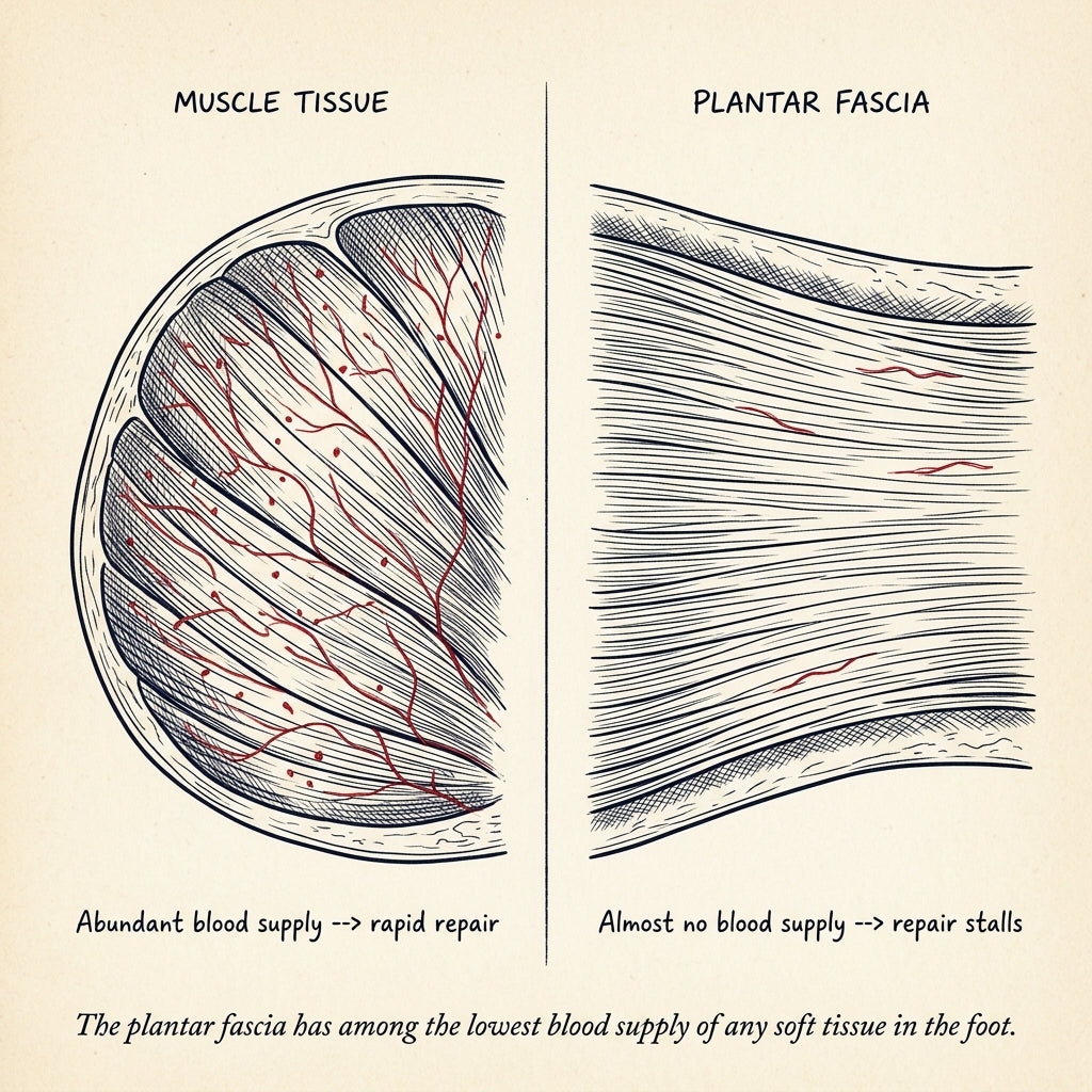 Hand-drawn anatomical comparison: muscle tissue with abundant blood vessels vs plantar fascia with sparse blood vessels