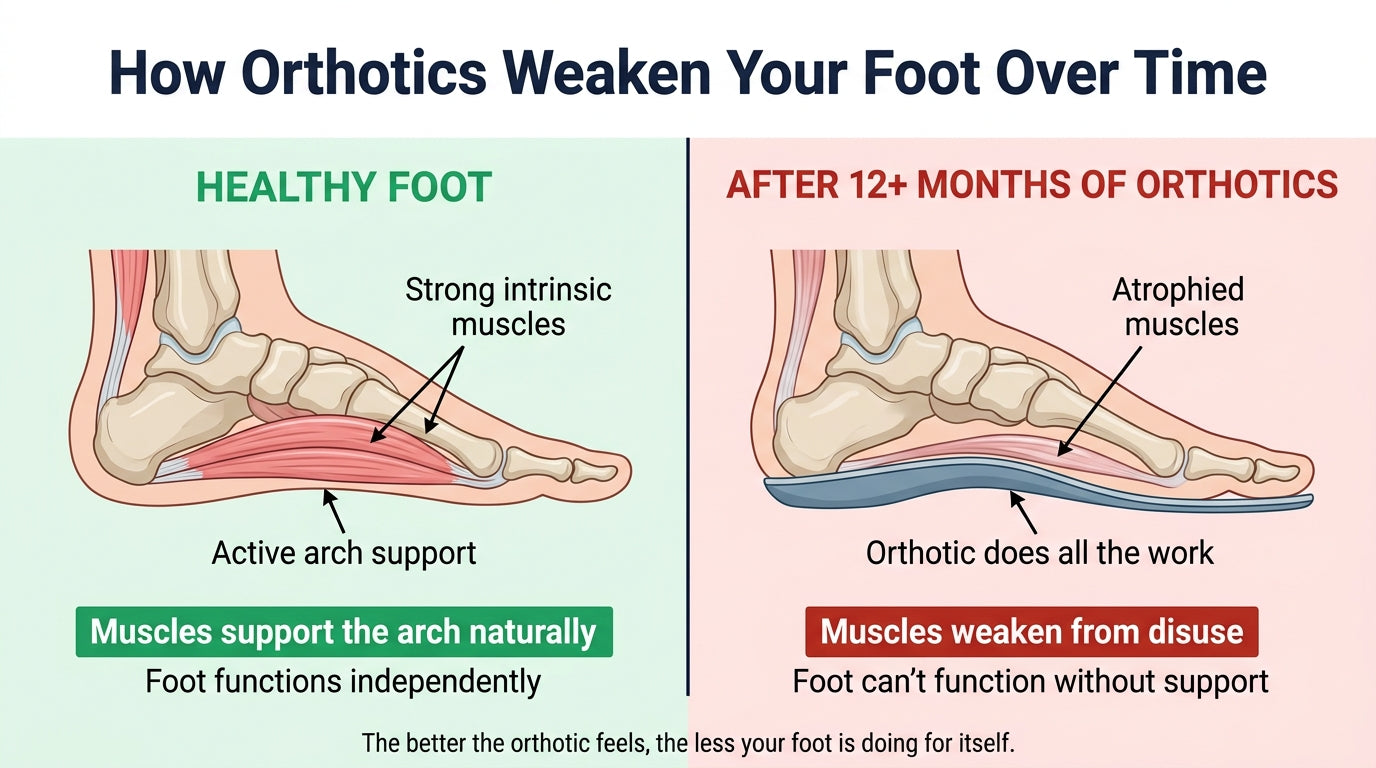 How orthotics weaken your foot over time -- healthy foot muscles vs atrophied muscles after 12+ months of orthotics