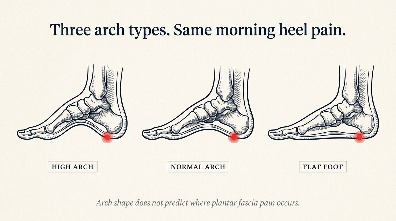 Three arch types — high, normal, flat — all showing the same red pain dot at the heel