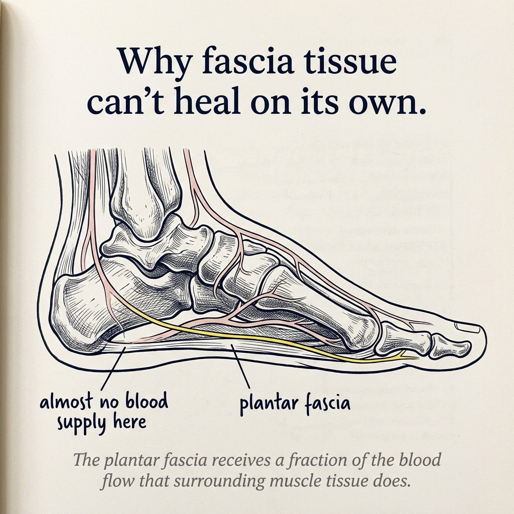 Cross-section diagram of the foot showing the plantar fascia and the depleted blood-vessel layer above it