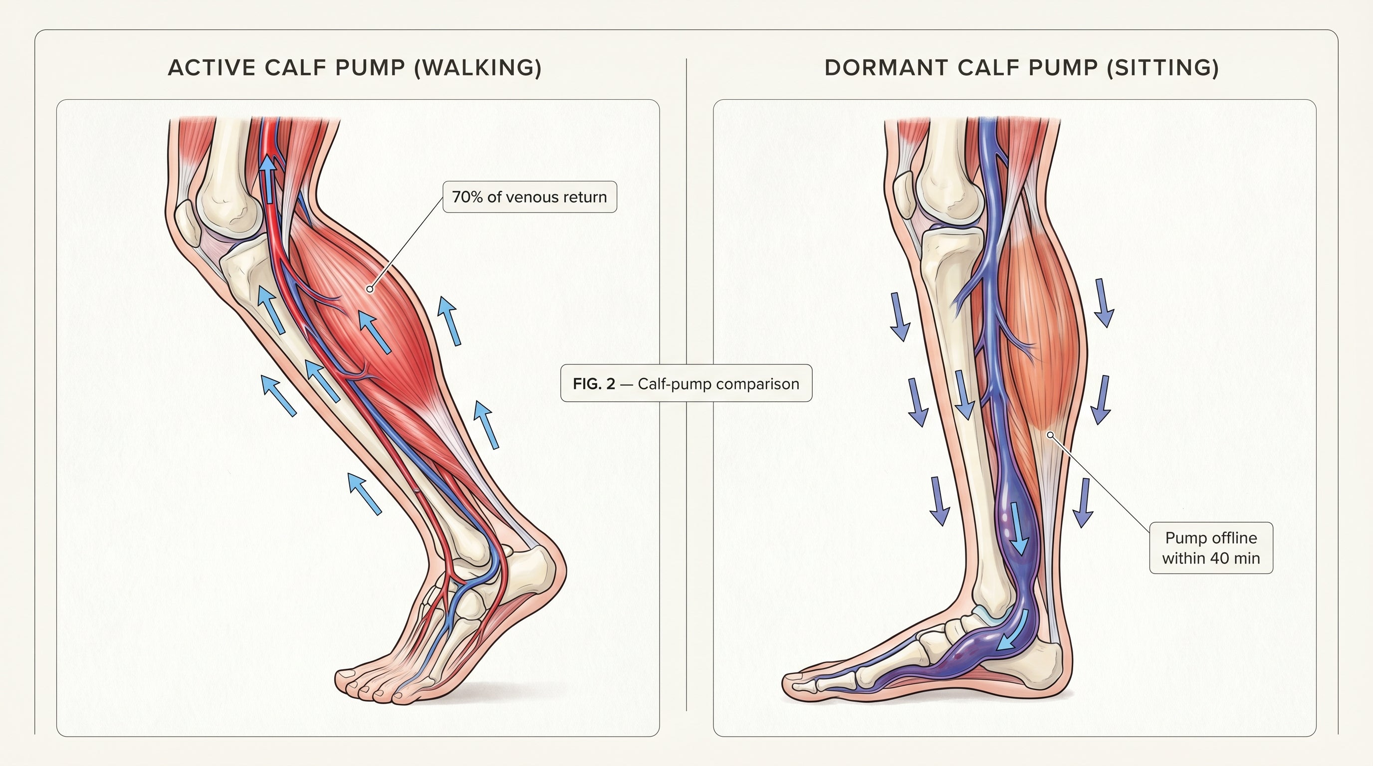 Comparison showing healthy active calf pump versus dormant sedentary calf pump