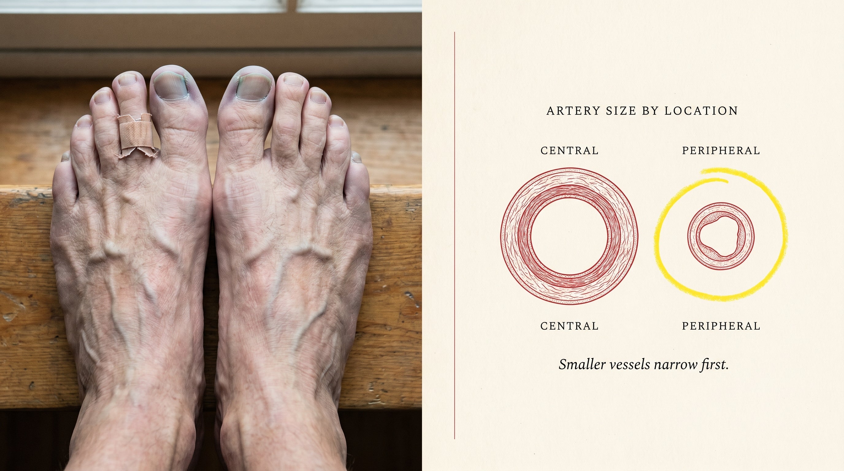 Bare feet showing the four visible signs of peripheral circulation aging beside an anatomical diagram comparing central and peripheral artery size