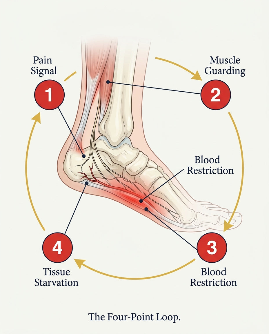 Anatomical diagram of the plantar fasciitis four-point loop showing pain signal, muscle guarding, blood restriction, and tissue starvation